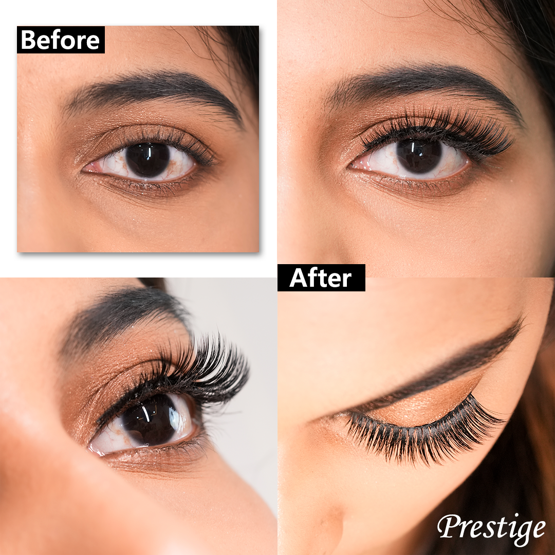 Prestige & Allure Value Kit